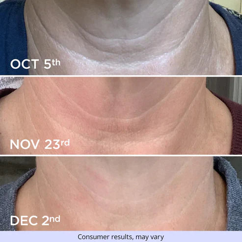 TIGHTEN & LIFT NECK CREAM