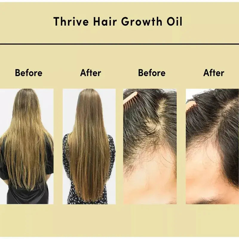 Hair Growth Essential Oil